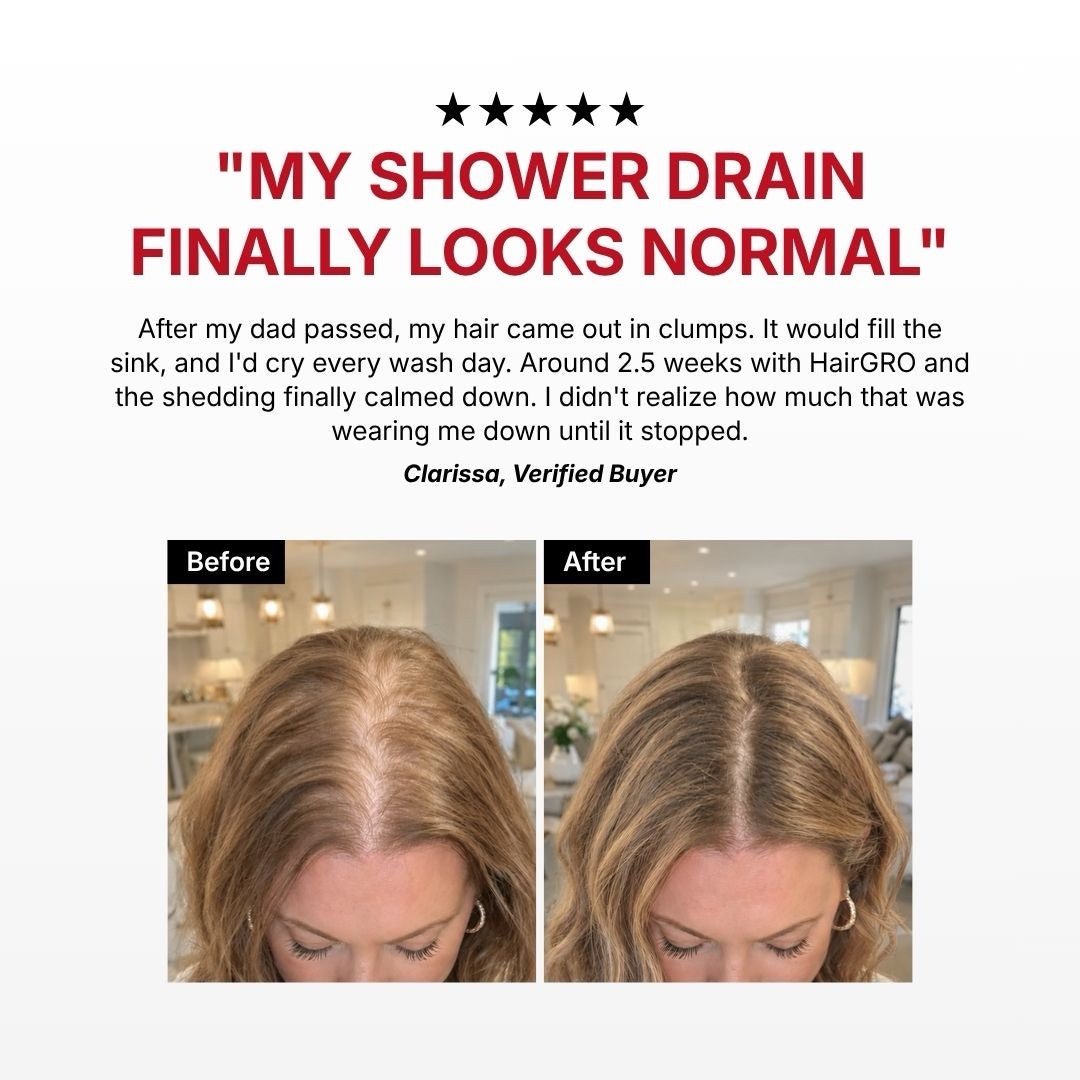 HairGRO™ 3-in-1 Hair Revival Brush - Kelosi