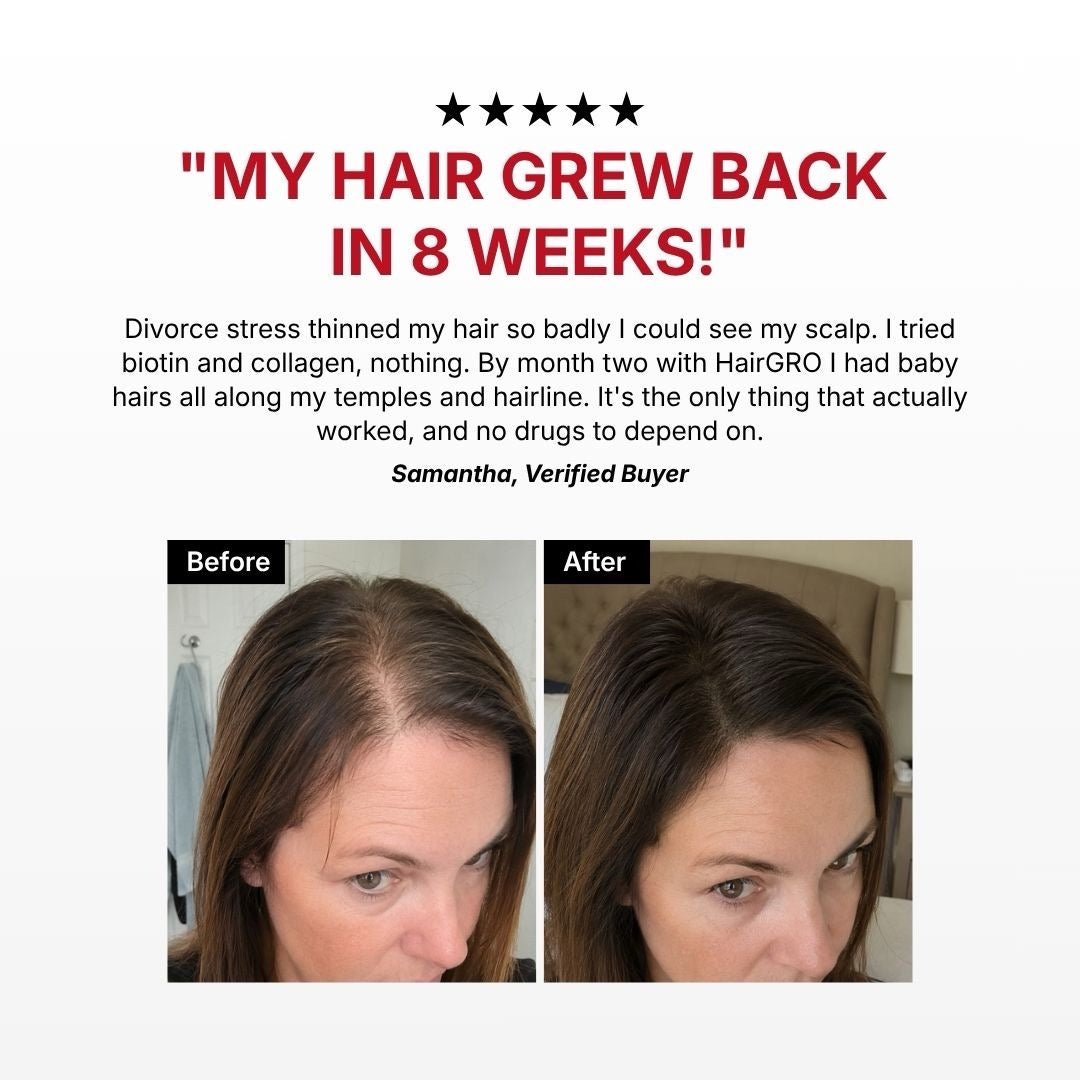 HairGRO™ 3-in-1 Hair Revival Brush - Kelosi