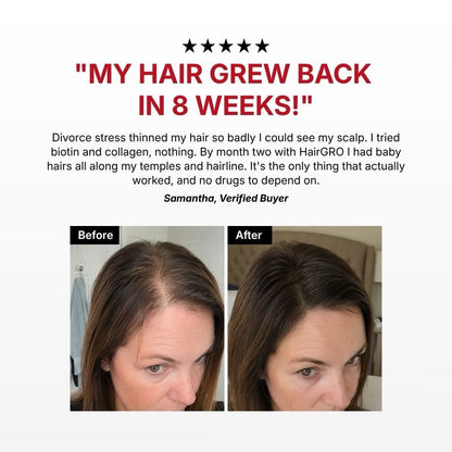 HairGRO™ 3-in-1 Hair Revival Brush - Kelosi